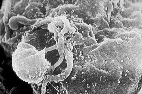 Electron micrograph of HIV virions budding from a cell