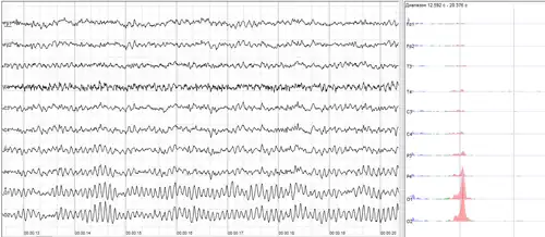 The sample of human EEG with prominent alpha-rhythm in occipital sites
