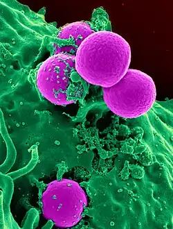 Colorized scanning electron micrograph of a human neutrophil ingesting MRSA