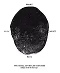 Myles Standish's skull discovered in the Standish gravesite at Myles Standish Burial Ground during an investigation of the grave