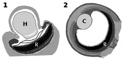 Grayscale diagrams of the structures of the ocelloid and vertebrate eye, showing analogous positional relationships between the hyalosome/lens and retinal body/retina.