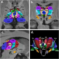 Four diagrams, three of which are photographs overlaid with multicolored visualizations of different parts of the brain. The fourth is a 3D rendition of these sections of the brain.