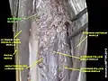 Anconeus muscle