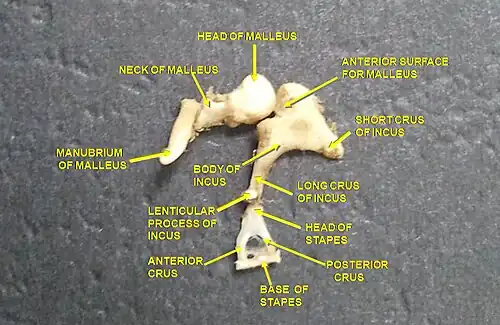 Auditory ossicles. Tympanic cavity. Deep dissection.