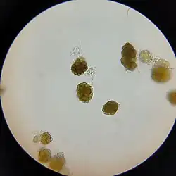 Brown clumps of cells under high magnification. Each clump is roughly oval and is composed of around twenty cells.