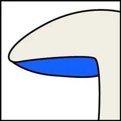 Blaszki przyrośnięte