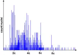 Rozkład aneuploidalny w komórkach z biopsji cienkoigłowej z przerzutu raka pęcherza moczowego