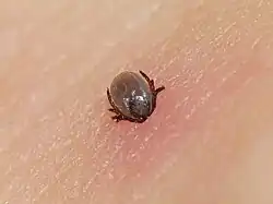 Kleszcz wbity w ludzką skórę