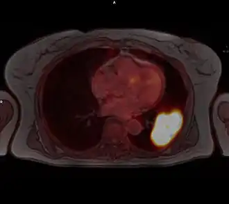 Bioskaner, Białystok