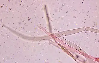 Strzępki skórki. Widoczna sprzążka