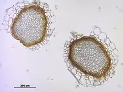 Obraz mikroskopowy dwóch zielonkawych przekrojów przez łodyżkę na jasnym tle