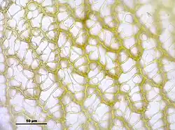 Obraz mikroskopowy komórek listka od strony grzbietowej