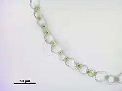 Przekrój poprzeczny przez listek gałązkowy