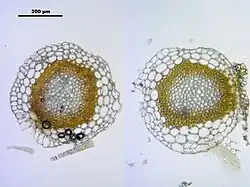 Obraz mikroskopowy, dwa okrągłe brązowozielone przekroje poprzeczne łodyżki na jasnym tle