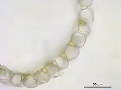 Obraz mikroskopowy, przekrój poprzeczny listka gałązkowego na jasnym tle