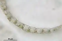 Przekrój przez listek gałązkowy